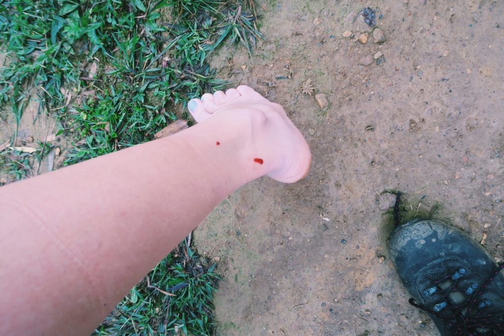 Leeches blood on Sapa trek in Vietnam